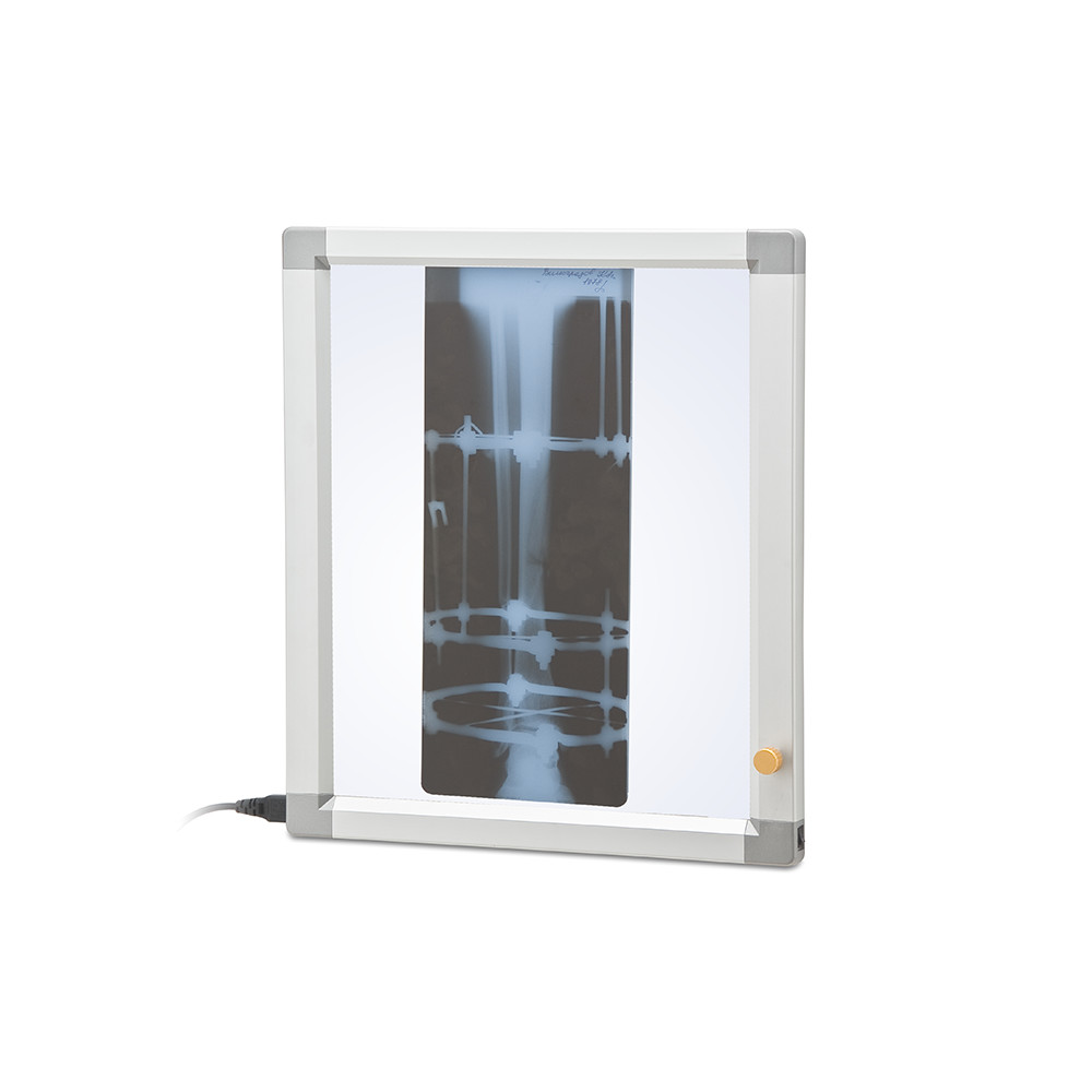 Негатоскопы — купить в Медмебель.ру